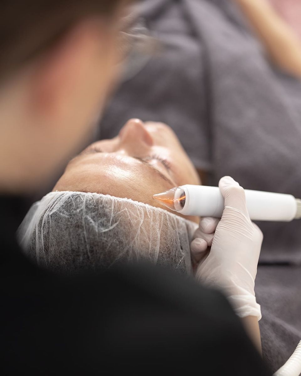 Cold Plasmabehandlung bei einer Kundin